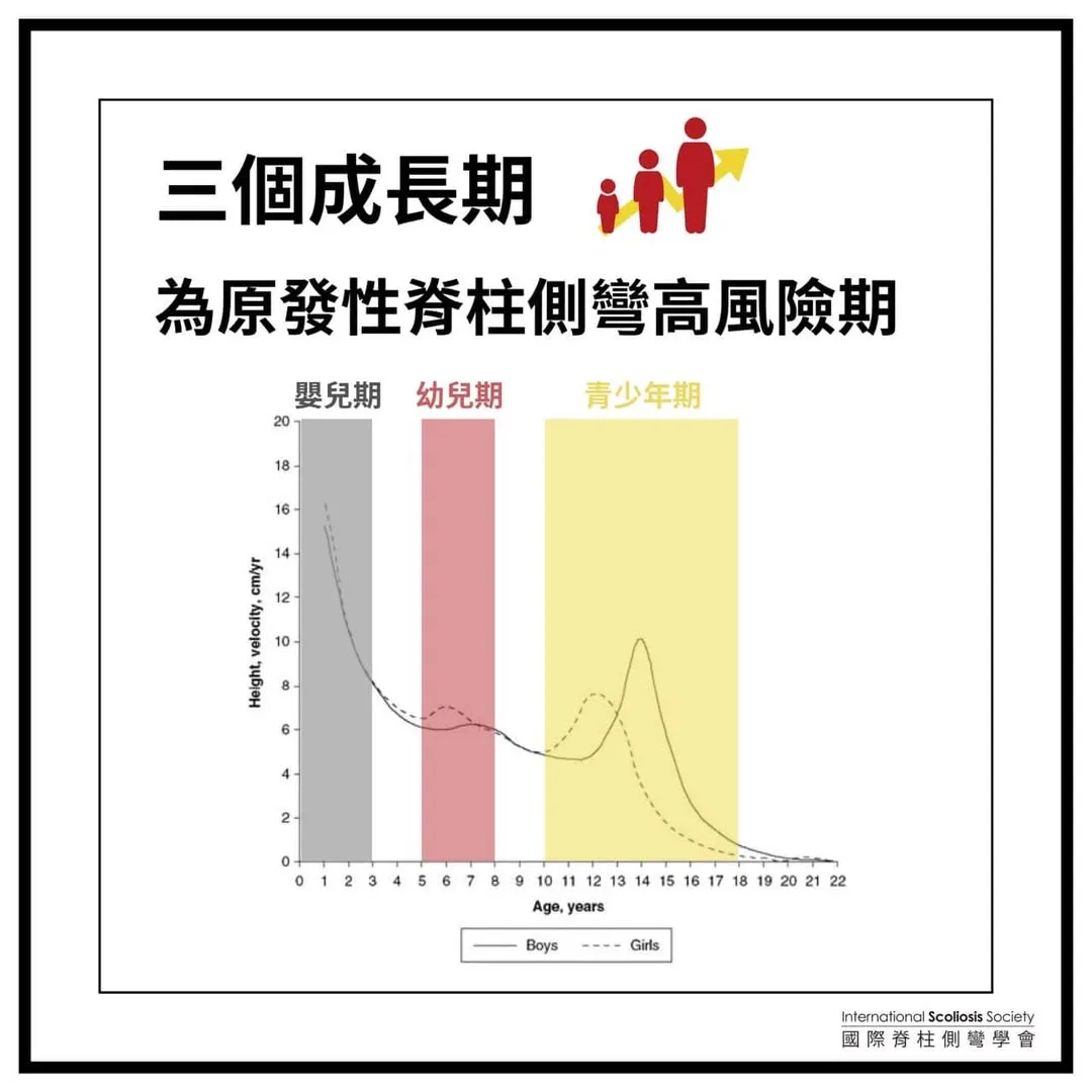 圖表卡：三個成長期為原發性脊柱側彎高風險期——男女身高生長速度（cm/年）對年齡曲線，標示嬰兒期（0–3 歲）、幼兒期（5–8 歲）、青少年期（10–18 歲）