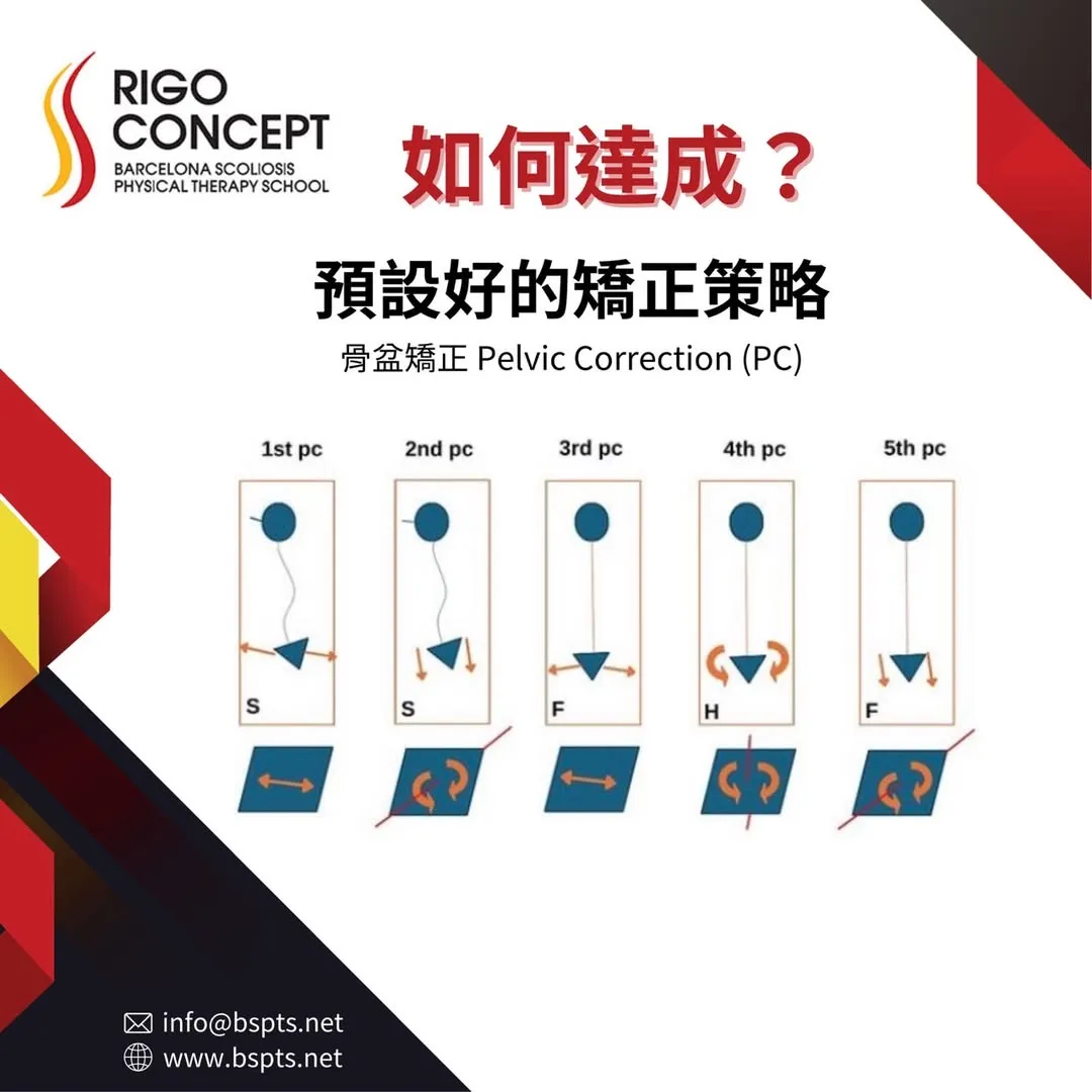 圖卡：「如何達成？預設好的矯正策略」——骨盆矯正 Pelvic Correction（PC）第 1 至第 5 種的示意圖，以頭部圓點、骨盆三角形與箭頭標示各種骨盆矯正方向