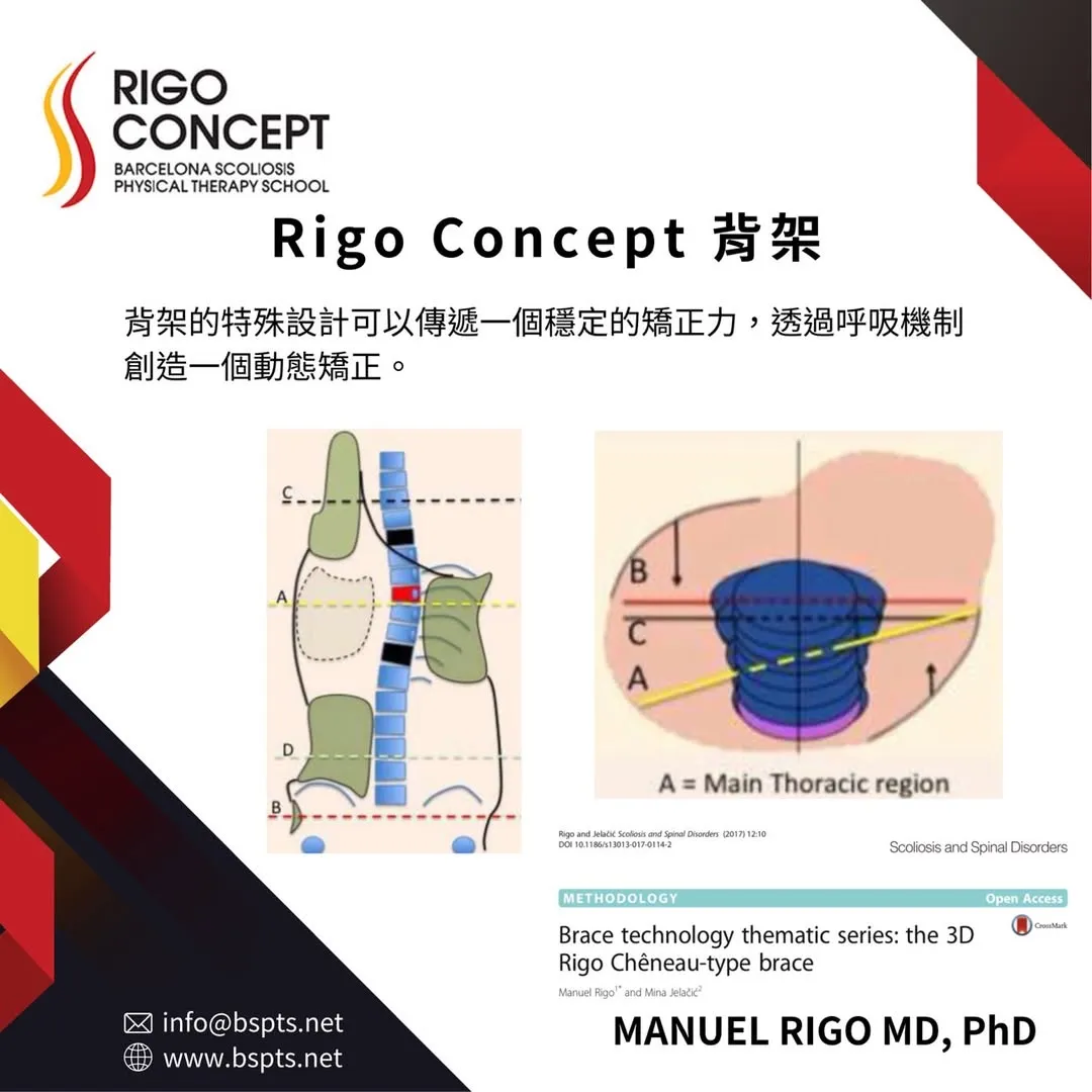 圖卡：Rigo Concept 背架——背架的特殊設計可傳遞穩定的矯正力，並透過呼吸機制創造動態矯正；附背架施力區與主胸椎區（A = Main Thoracic region）橫切面示意圖，出自 Rigo 與 Jelačić 2017 年論文