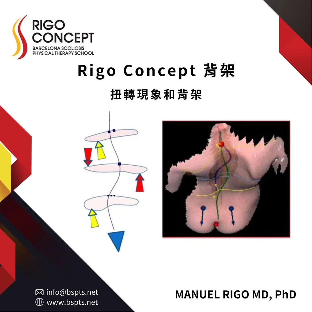 圖卡：Rigo Concept 背架——扭轉現象和背架；左為各節段反向旋轉力的箭頭示意圖，右為背部表面 3D 掃描影像，標示脊柱線與旋轉方向