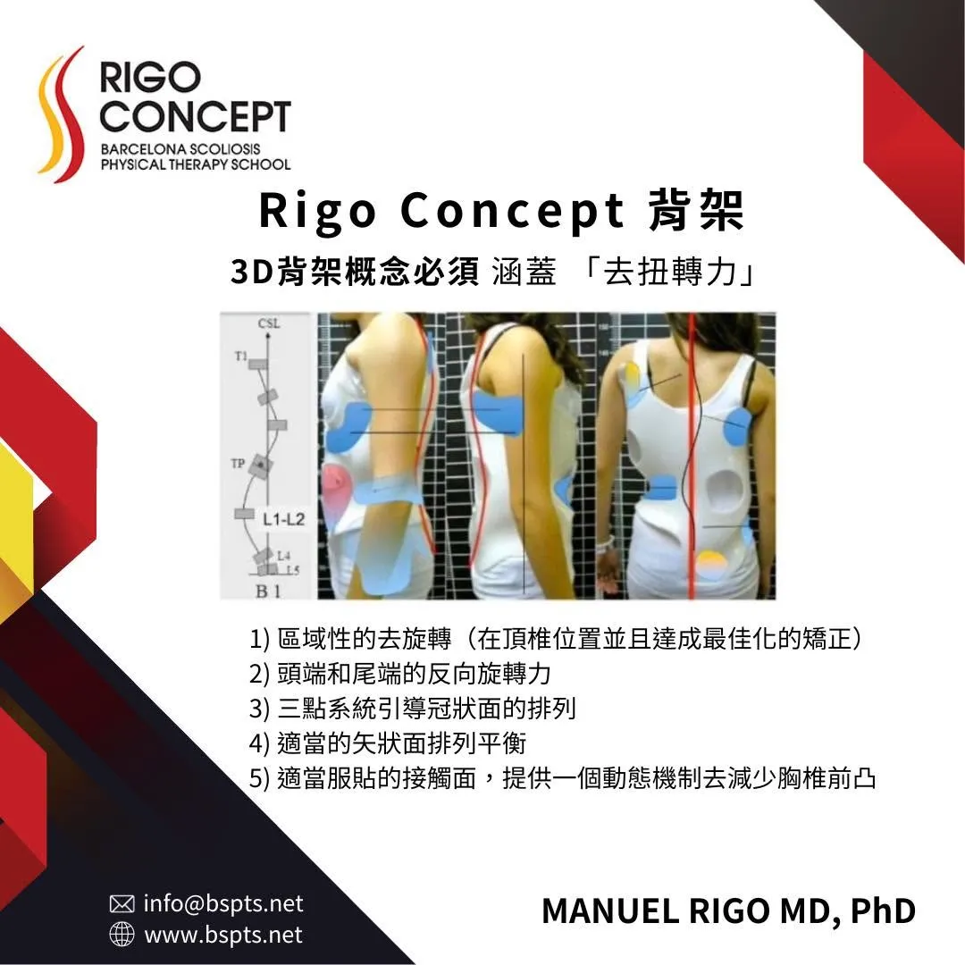 圖卡：Rigo Concept 背架——3D背架概念必須涵蓋「去扭轉力」：區域性去旋轉、頭端和尾端反向旋轉力、三點系統引導冠狀面排列、適當矢狀面排列平衡、適當服貼的接觸面；附 B1 類型脊柱示意與穿戴背架的施力區示意照片
