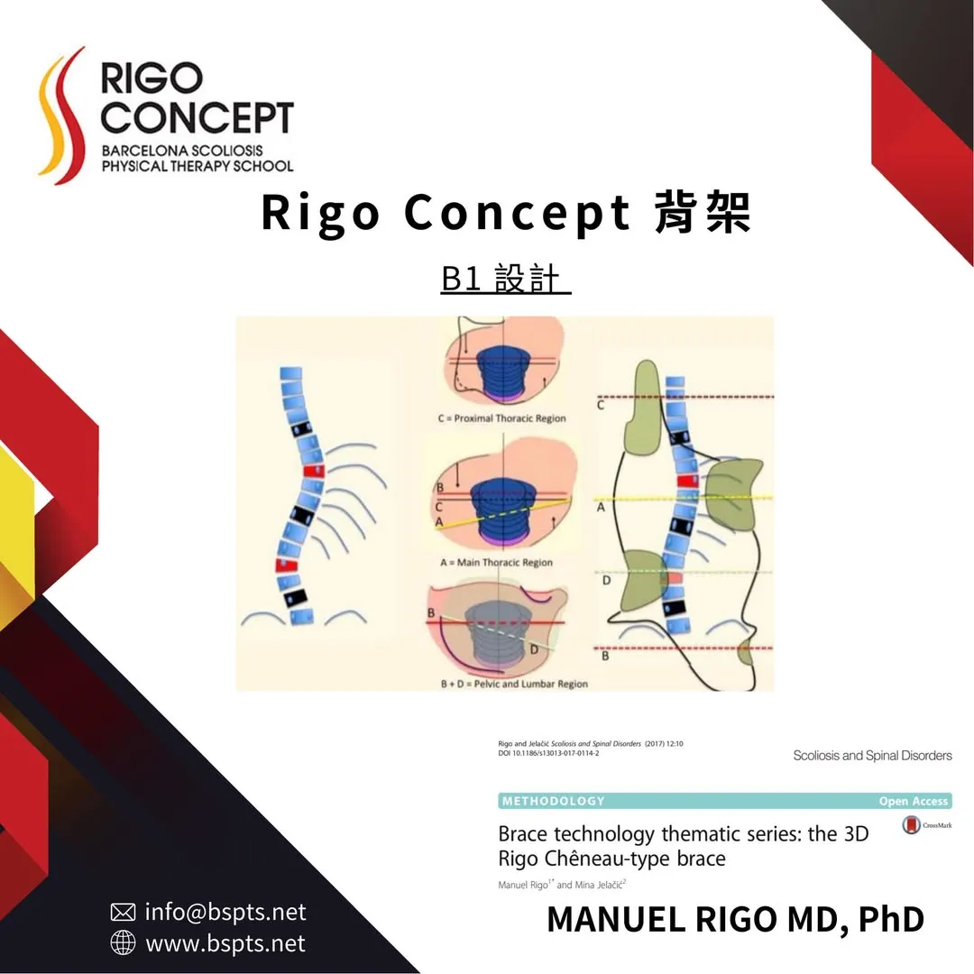 圖卡：Rigo Concept 背架 B1 設計——雙彎脊柱示意圖，搭配近端胸椎區（C）、主胸椎區（A）、骨盆與腰椎區（B + D）的橫切面施力示意與背架輪廓圖