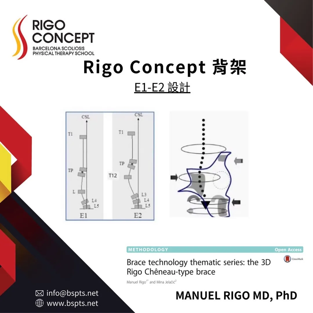 圖卡：Rigo Concept 背架 E1–E2 設計——E1 與 E2 類型的脊柱節段排列示意圖（標示 CSL、T1、TP、T12、L3–L5），以及背架輪廓與施力方向示意圖