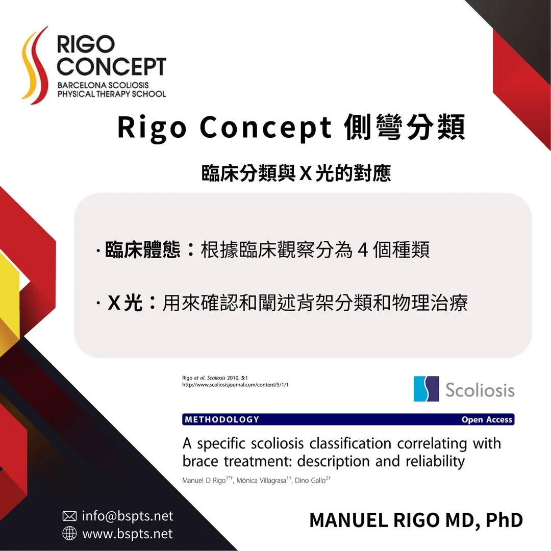 圖卡：Rigo Concept 側彎分類——臨床分類與 X 光的對應。臨床體態：根據臨床觀察分為 4 個種類；X 光：用來確認和闡述背架分類和物理治療
