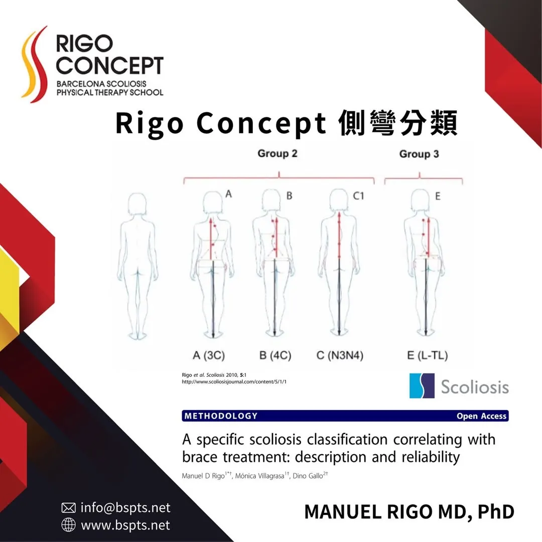 圖示：Rigo Concept 側彎分類的背面體態示意，Group 2 包含 A（3C）、B（4C）、C（N3N4），Group 3 為 E（L-TL），並與正常體態對照；出自 Rigo 等人 2010 年論文