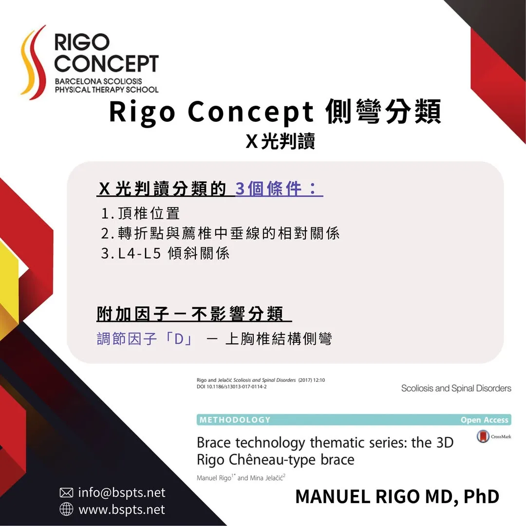 圖卡：Rigo Concept 側彎分類——X 光判讀分類的 3 個條件：頂椎位置、轉折點與薦椎中垂線的相對關係、L4-L5 傾斜關係；附加因子「D」（上胸椎結構側彎）不影響分類