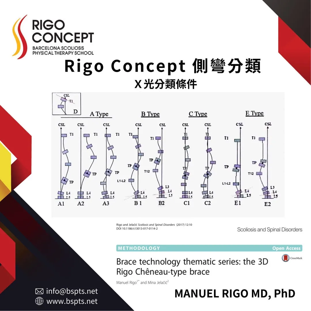 圖示：Rigo Concept 側彎分類的 X 光分類條件，以薦椎中垂線（CSL）、轉折點（TP）與 L4-L5 示意 A1–A3、B1–B2、C1–C2、E1–E2 各亞型，另標示調節因子 D