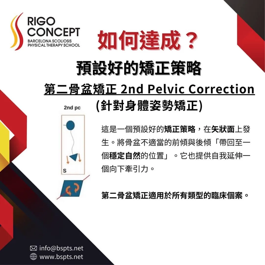 圖卡：如何達成？預設好的矯正策略——第二骨盆矯正（2nd Pelvic Correction，針對身體姿勢矯正）。矢狀面示意圖：將骨盆不適當的前傾與後傾帶回穩定自然的位置，並提供自我延伸向下牽引力；適用於所有類型臨床個案