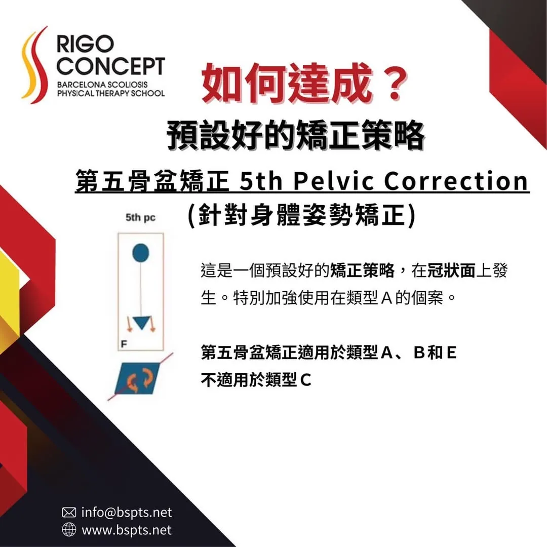 圖卡：如何達成？預設好的矯正策略——第五骨盆矯正（5th Pelvic Correction，針對身體姿勢矯正）。冠狀面示意圖，特別加強使用在類型A的個案；適用於類型A、B和E，不適用於類型C