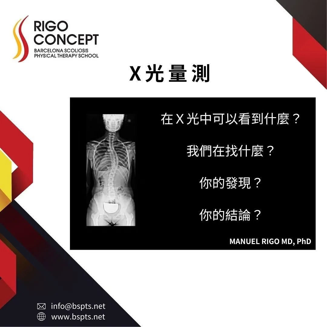 圖卡：X 光量測——列出四個判讀提問：在 X 光中可以看到什麼？我們在找什麼？你的發現？你的結論？旁附一張全脊椎正面 X 光片